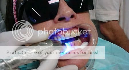 Clareamento Dental a Laser Clareamento Dental a Laser