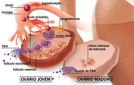 Menopausa