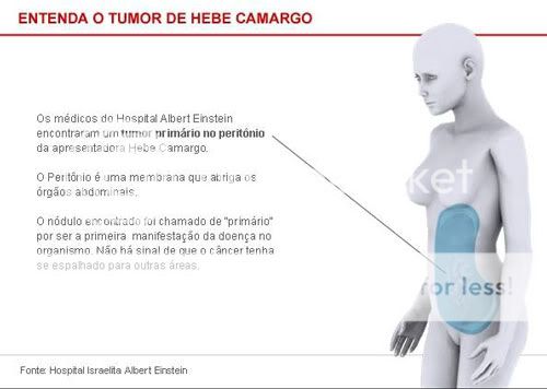 Tumor Hebe Camargo Tumor Hebe Camargo